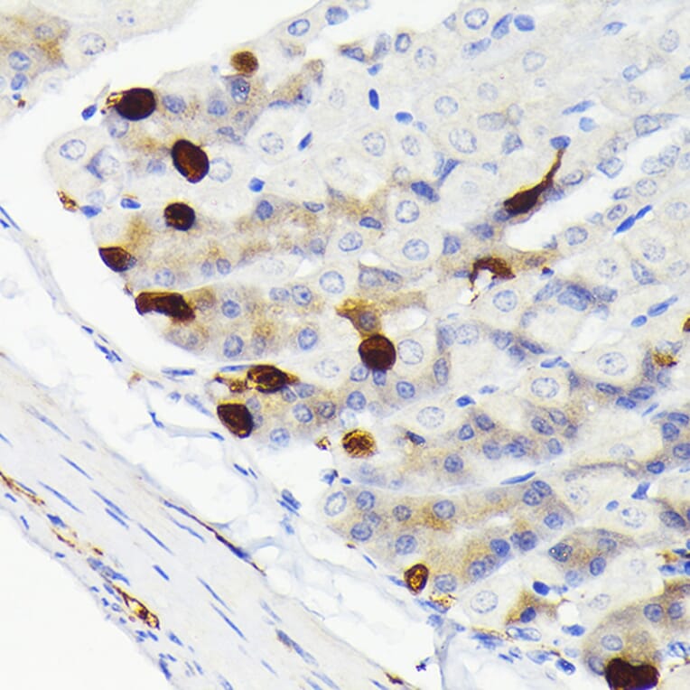 Immunohistochemistry - Anti-SCGN/Secretagogin Antibody [ARC2196] (A306306) - Antibodies.com