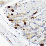 Immunohistochemistry - Anti-SCGN/Secretagogin Antibody [ARC2196] (A306306) - Antibodies.com