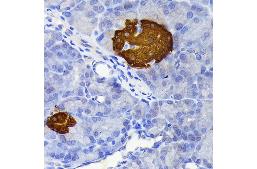 Immunohistochemistry - Anti-SCGN/Secretagogin Antibody [ARC2196] (A306306) - Antibodies.com