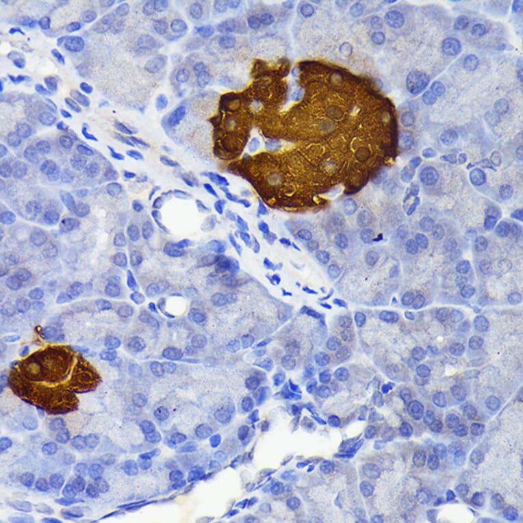 Immunohistochemistry - Anti-SCGN/Secretagogin Antibody [ARC2196] (A306306) - Antibodies.com