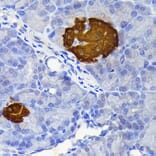 Immunohistochemistry - Anti-SCGN/Secretagogin Antibody [ARC2196] (A306306) - Antibodies.com