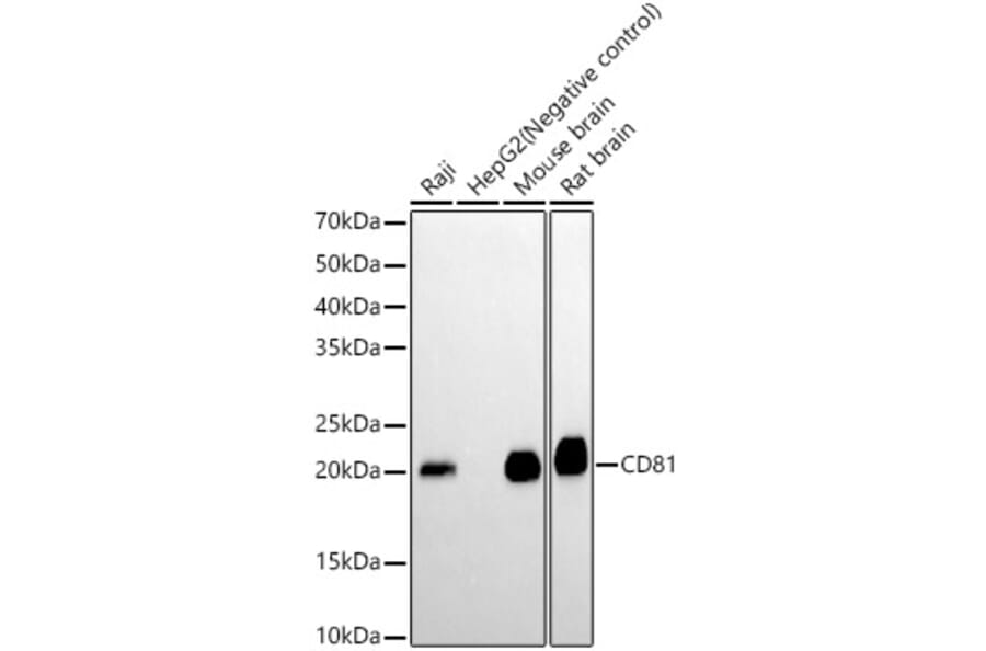 Western Blot - Anti-CD81 Antibody [ARC0615] (A306308) - Antibodies.com