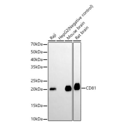 Western Blot - Anti-CD81 Antibody [ARC0615] (A306308) - Antibodies.com