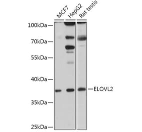 Western Blot - Anti-ELOVL2 Antibody (A306309) - Antibodies.com