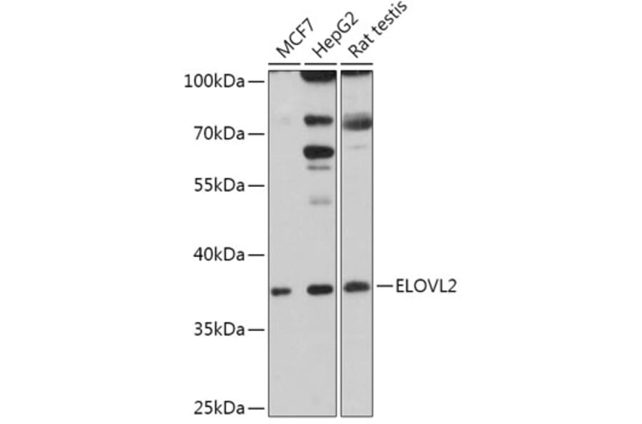 Western Blot - Anti-ELOVL2 Antibody (A306309) - Antibodies.com