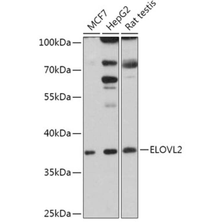 Western Blot - Anti-ELOVL2 Antibody (A306309) - Antibodies.com