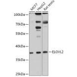 Western Blot - Anti-ELOVL2 Antibody (A306309) - Antibodies.com