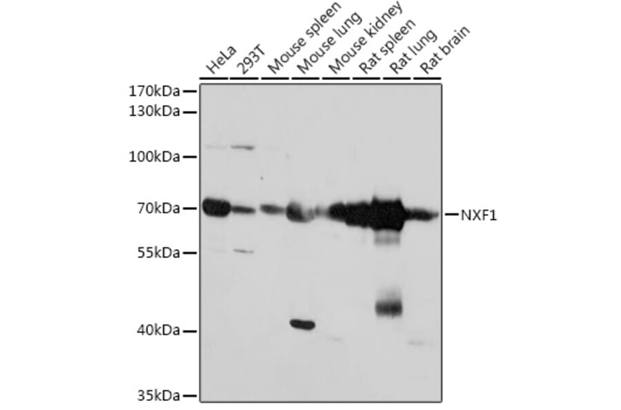 Western Blot - Anti-NXF1 Antibody (A306312) - Antibodies.com