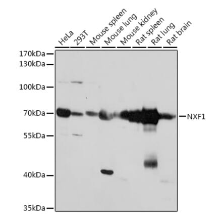 Western Blot - Anti-NXF1 Antibody (A306312) - Antibodies.com