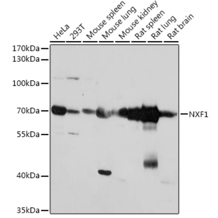 Western Blot - Anti-NXF1 Antibody (A306312) - Antibodies.com