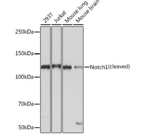 Western Blot - Anti-Notch1 Antibody [ARC0285] (A306313) - Antibodies.com
