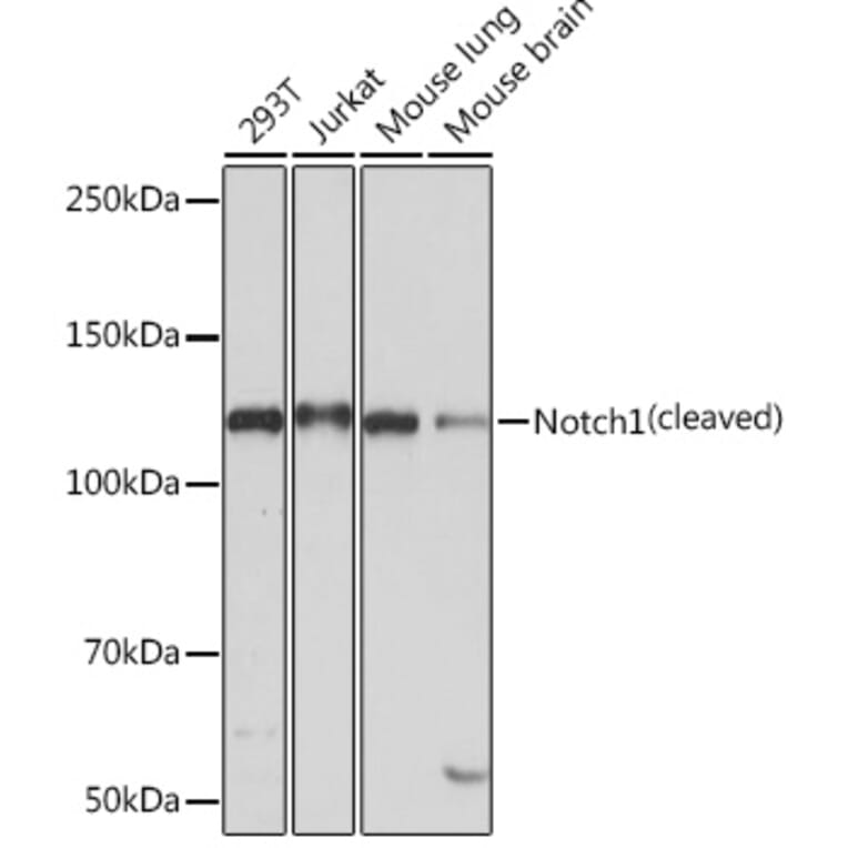 Western Blot - Anti-Notch1 Antibody [ARC0285] (A306313) - Antibodies.com