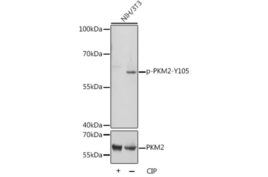 Western Blot - Anti-PKM2 (Phospho Y105) Antibody (A306314) - Antibodies.com