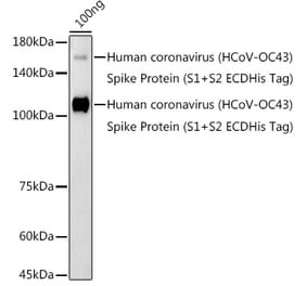 Western Blot - Anti-Human Coronavirus Spike glycoprotein Antibody (A306317) - Antibodies.com