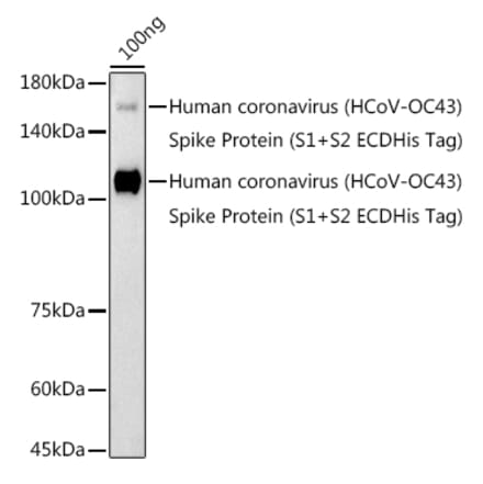 Western Blot - Anti-Human Coronavirus Spike glycoprotein Antibody (A306317) - Antibodies.com