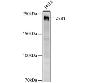 Western Blot - Anti-ZEB1 Antibody [ARC53599] (A306318) - Antibodies.com