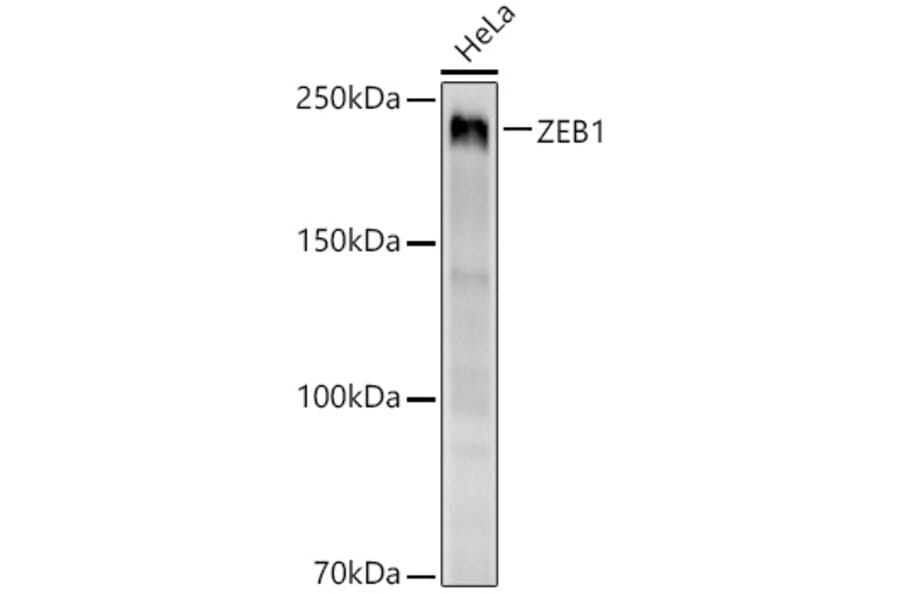 Western Blot - Anti-ZEB1 Antibody [ARC53599] (A306318) - Antibodies.com