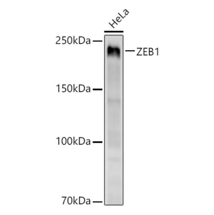 Western Blot - Anti-ZEB1 Antibody [ARC53599] (A306318) - Antibodies.com