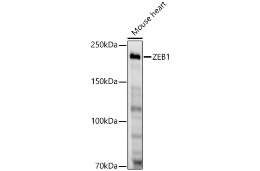 Western Blot - Anti-ZEB1 Antibody [ARC53599] (A306318) - Antibodies.com