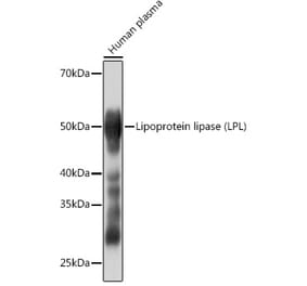 Western Blot - Anti-Lipoprotein lipase Antibody [ARC0904] (A306319) - Antibodies.com