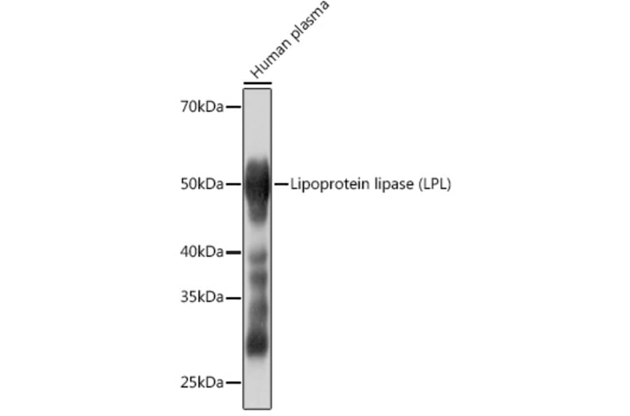 Western Blot - Anti-Lipoprotein lipase Antibody [ARC0904] (A306319) - Antibodies.com