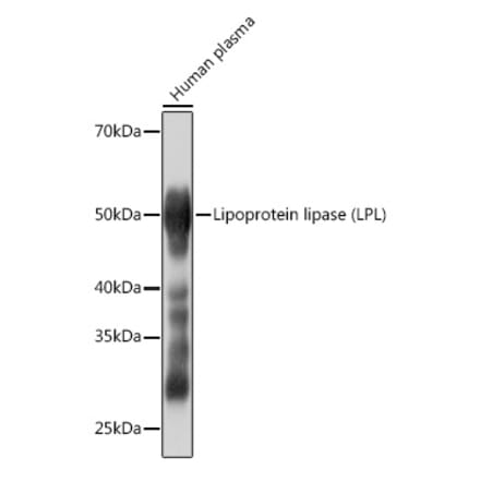 Western Blot - Anti-Lipoprotein lipase Antibody [ARC0904] (A306319) - Antibodies.com
