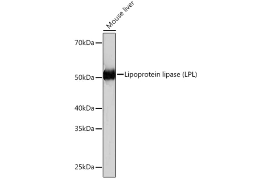 Western Blot - Anti-Lipoprotein lipase Antibody [ARC0904] (A306319) - Antibodies.com