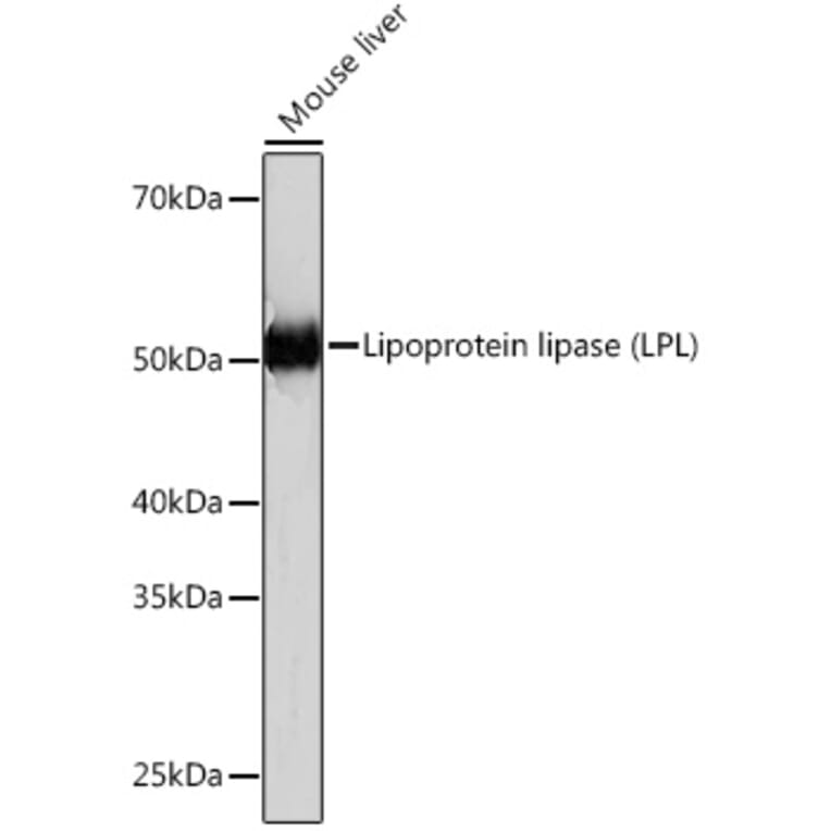 Western Blot - Anti-Lipoprotein lipase Antibody [ARC0904] (A306319) - Antibodies.com