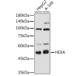 Western Blot - Anti-HEXA Antibody (A306320) - Antibodies.com