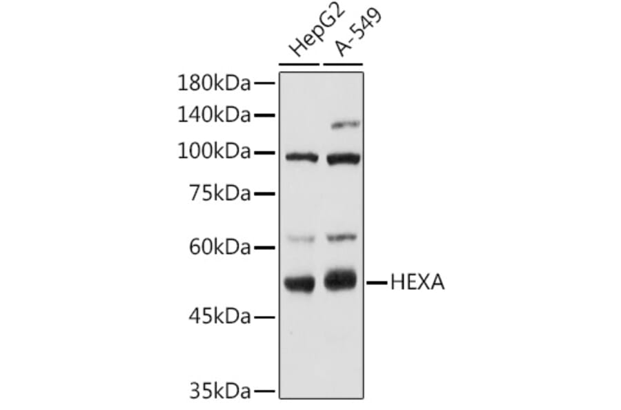 Western Blot - Anti-HEXA Antibody (A306320) - Antibodies.com