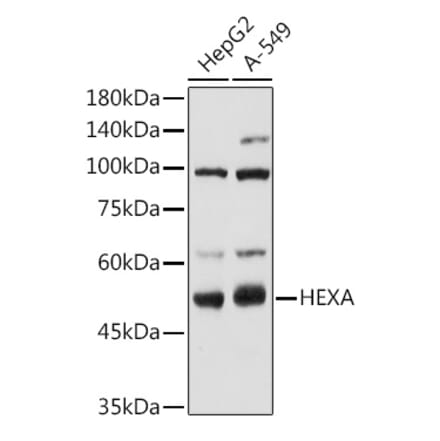 Western Blot - Anti-HEXA Antibody (A306320) - Antibodies.com