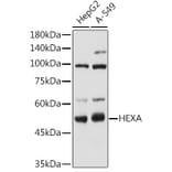 Western Blot - Anti-HEXA Antibody (A306320) - Antibodies.com