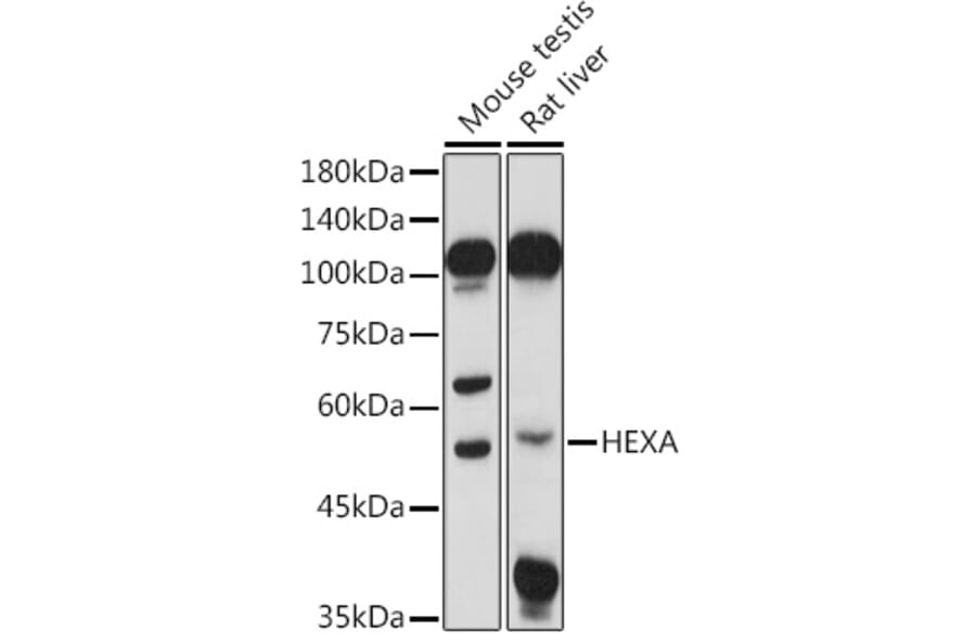 Western Blot - Anti-HEXA Antibody (A306320) - Antibodies.com