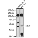 Western Blot - Anti-HEXA Antibody (A306320) - Antibodies.com