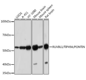 Western Blot - Anti-TIP49A Antibody [ARC1247] (A306321) - Antibodies.com