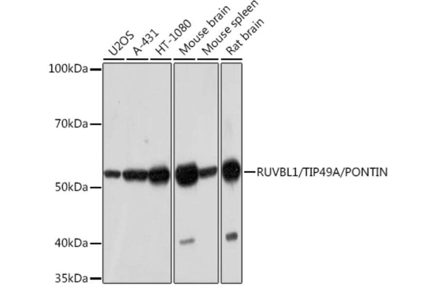 Western Blot - Anti-TIP49A Antibody [ARC1247] (A306321) - Antibodies.com