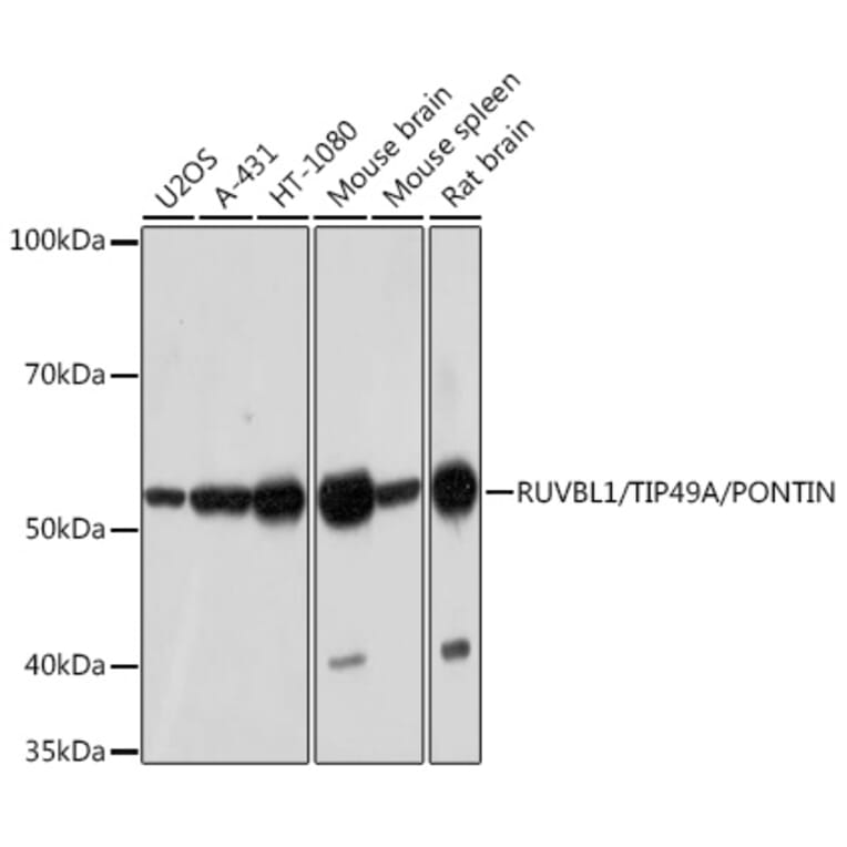 Western Blot - Anti-TIP49A Antibody [ARC1247] (A306321) - Antibodies.com