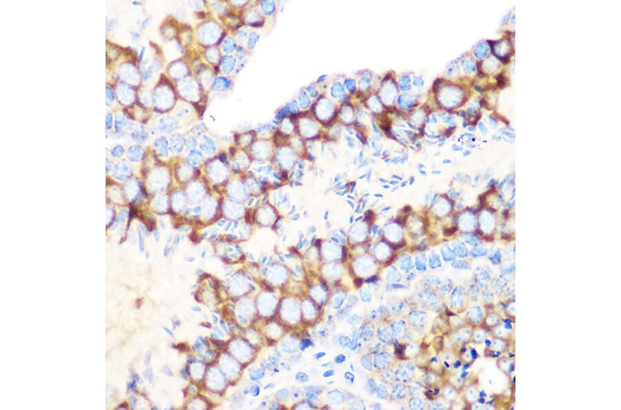 Immunohistochemistry - Anti-TIP49A Antibody [ARC1247] (A306321) - Antibodies.com