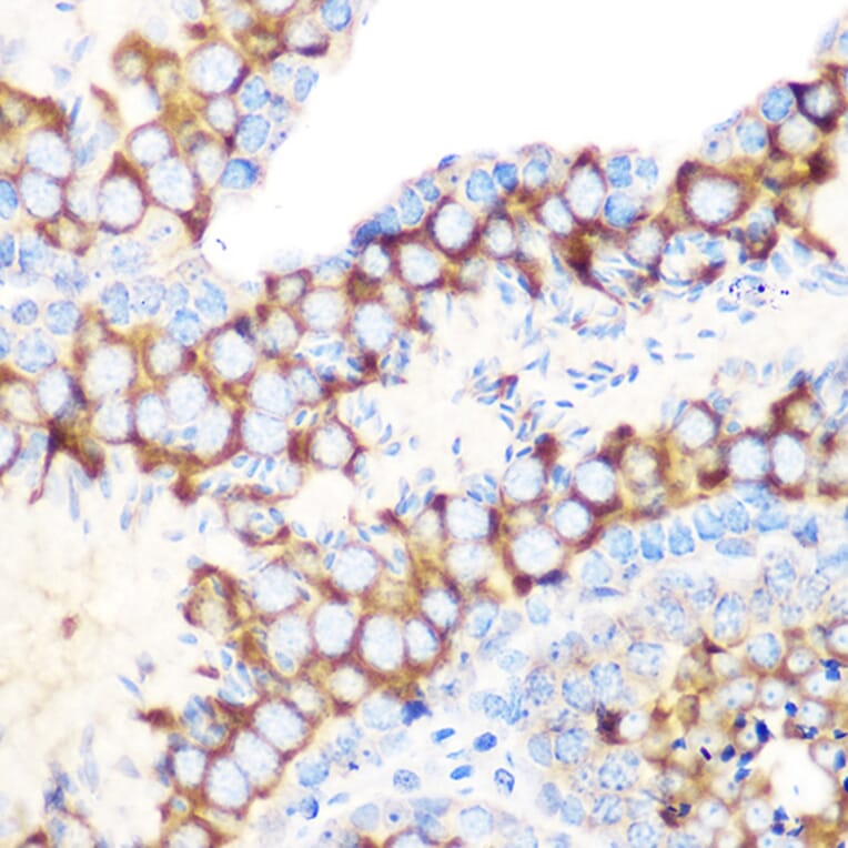 Immunohistochemistry - Anti-TIP49A Antibody [ARC1247] (A306321) - Antibodies.com