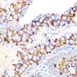 Immunohistochemistry - Anti-TIP49A Antibody [ARC1247] (A306321) - Antibodies.com