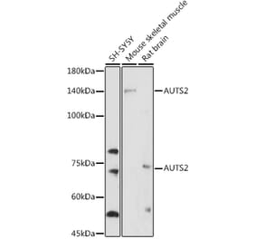 Western Blot - Anti-AUTS2 Antibody (A306322) - Antibodies.com