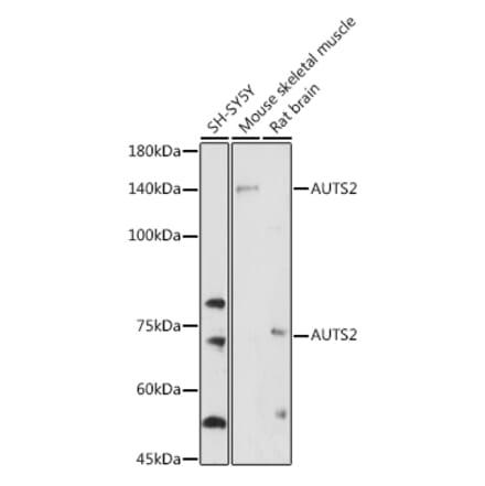 Western Blot - Anti-AUTS2 Antibody (A306322) - Antibodies.com