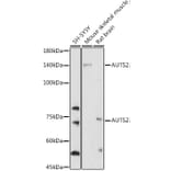 Western Blot - Anti-AUTS2 Antibody (A306322) - Antibodies.com