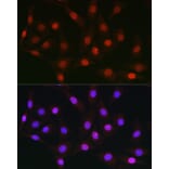 Immunofluorescence - Anti-AUTS2 Antibody (A306322) - Antibodies.com