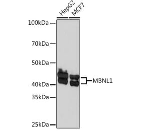 Western Blot - Anti-MBNL1 Antibody [ARC1199] (A306323) - Antibodies.com