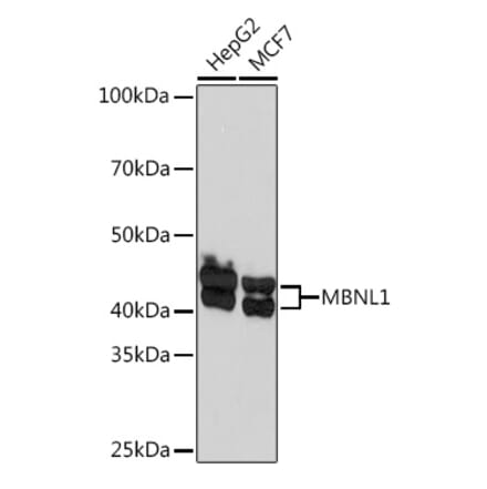 Western Blot - Anti-MBNL1 Antibody [ARC1199] (A306323) - Antibodies.com