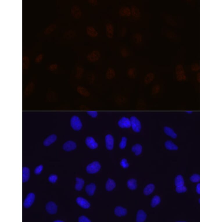 Immunofluorescence - Anti-MBNL1 Antibody [ARC1199] (A306323) - Antibodies.com