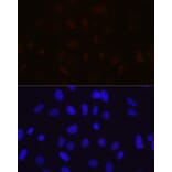 Immunofluorescence - Anti-MBNL1 Antibody [ARC1199] (A306323) - Antibodies.com