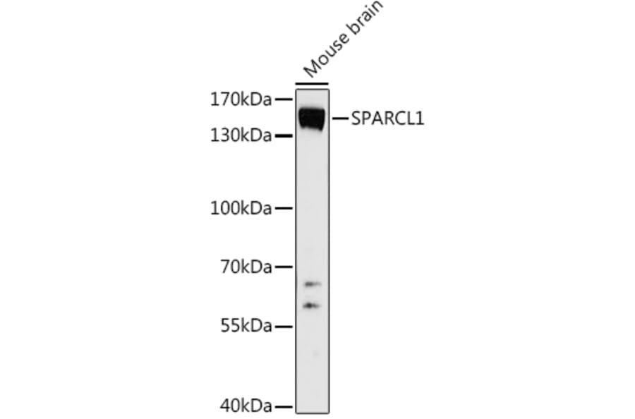 Western Blot - Anti-SPARCL1 Antibody (A306325) - Antibodies.com