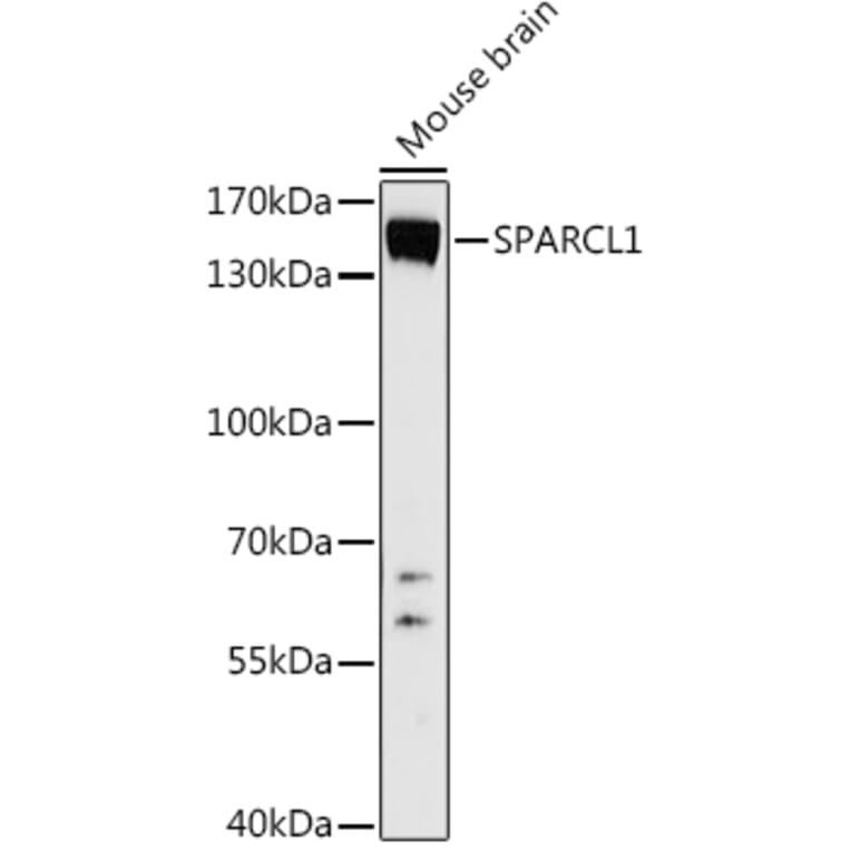 Western Blot - Anti-SPARCL1 Antibody (A306325) - Antibodies.com